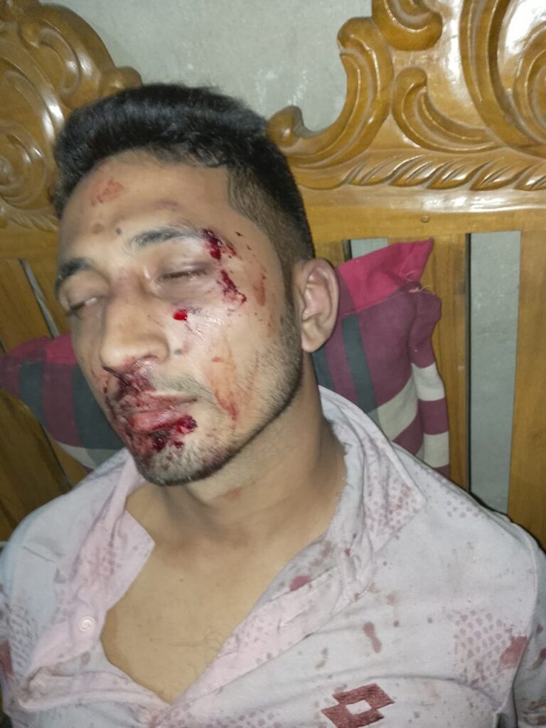 মিরসরাইয়ে ছাত্রদল নেতাকে পিটিয়ে রক্তাক্ত করলো ছাত্রলীগ